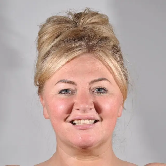 Precious Dental patient smiling after treatment